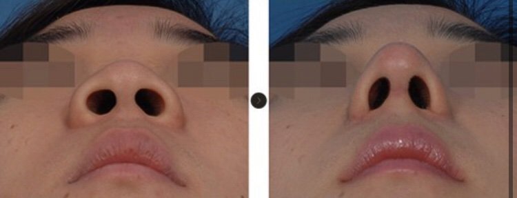 smaller nose subliminal results