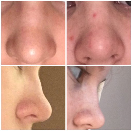 nose subliminal results