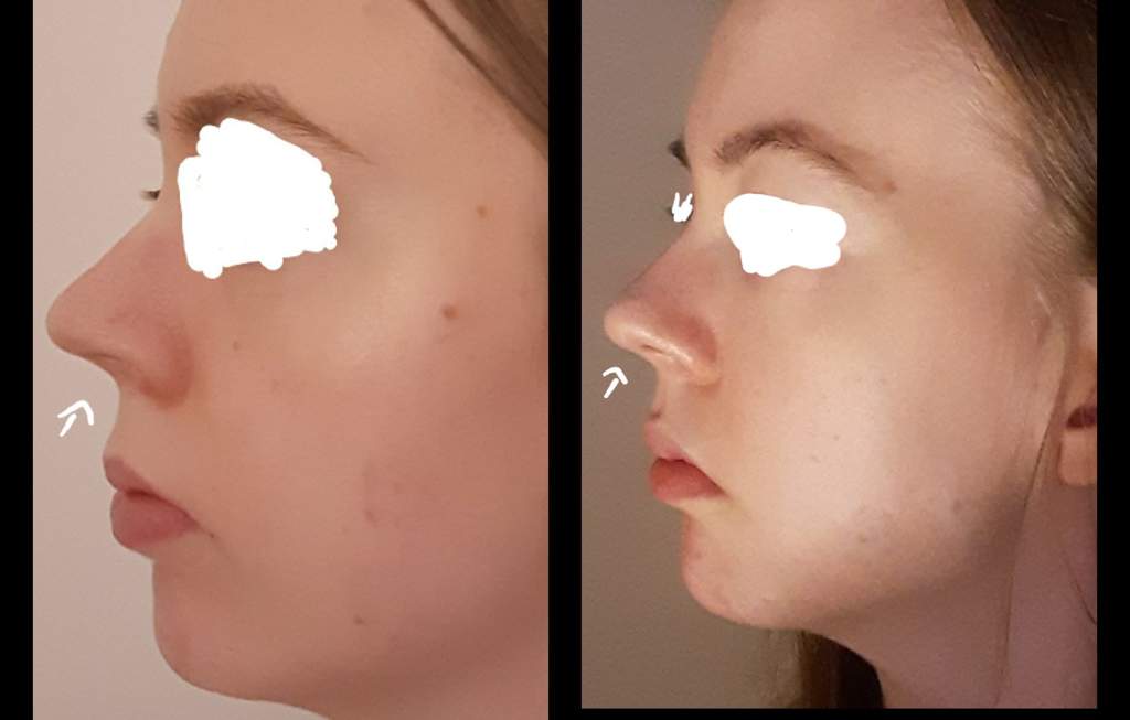 nose subliminal results