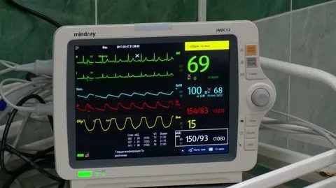 Сатурация на ивл. Монитор Филипс Efficia cm120. Монитор пациента модульный Monet n5. МПР 03 кардиомонитор.