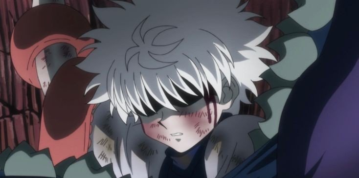 Killua Zoldyck Wiki امبراطورية الأنمي Amino