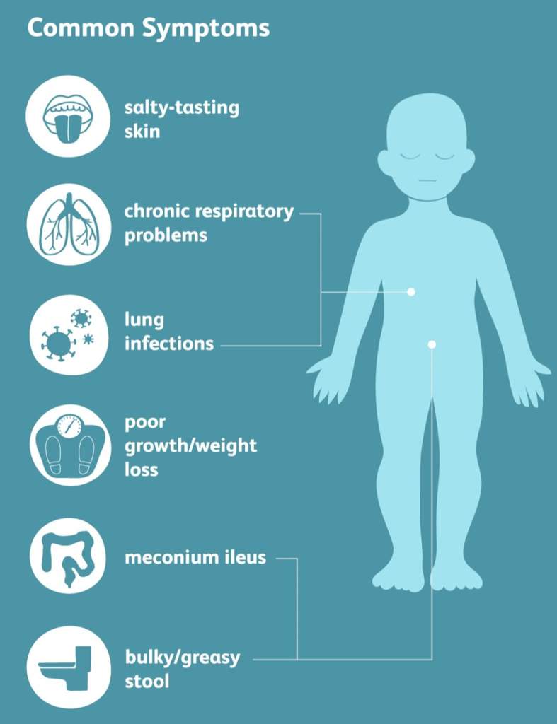 Cystic Fibrosis | Wiki | How We Survive: Living w/ CI Amino