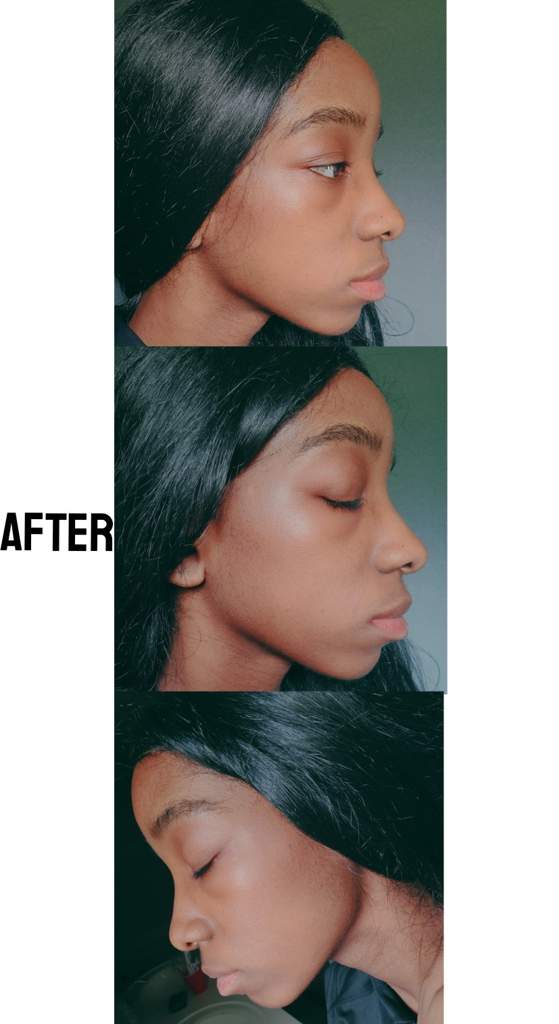 9-ways-to-get-a-perfect-jawline-dr-renu